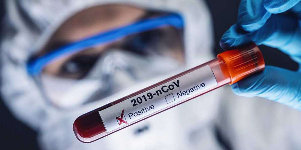 Do 90% „pozytywnych” wyników testów C-19 jest fałszywych