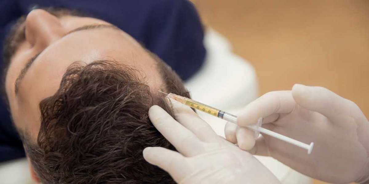 PRP Treatment