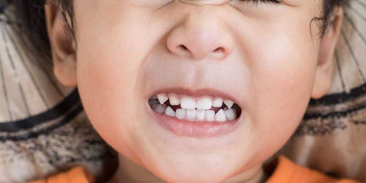 X264 What Causes Teeth Grinding In Children Watch Online Free Watch Online