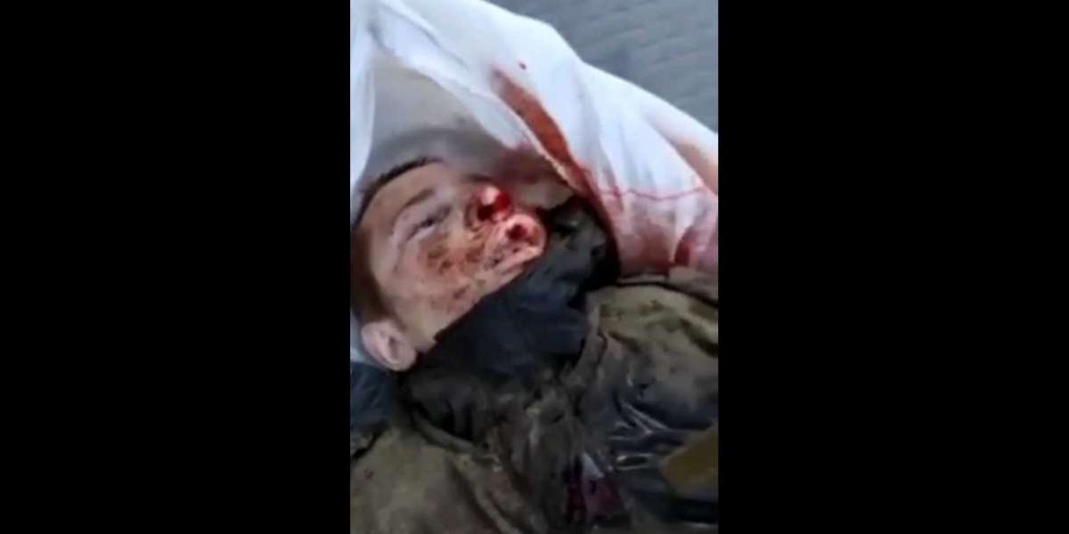 Ukraina to ISIS, Niech cały Świat zobaczy