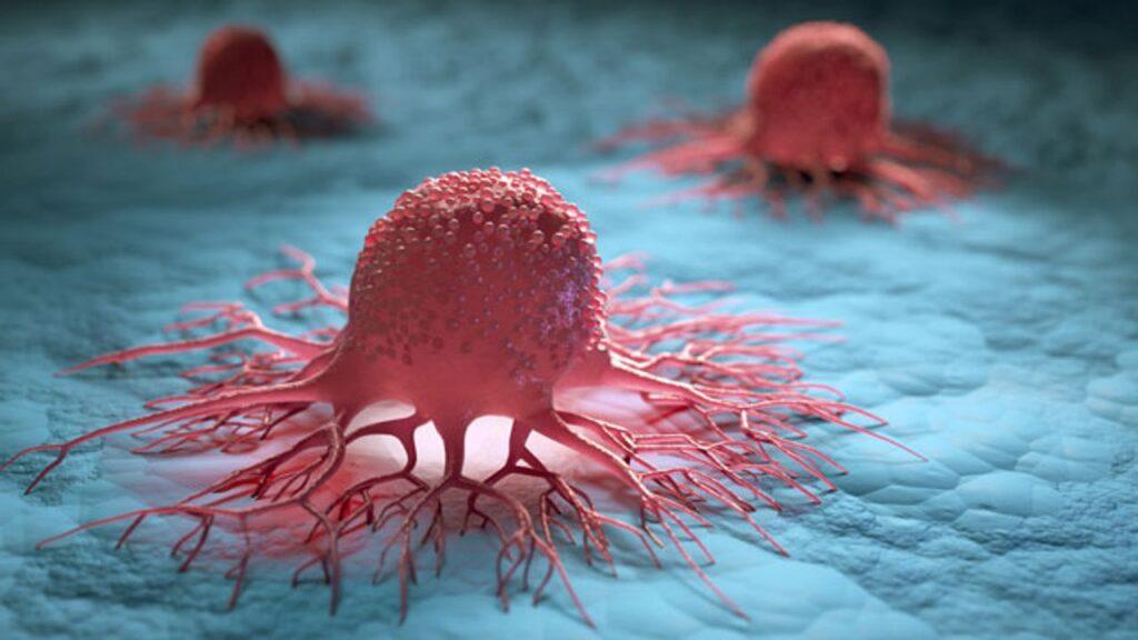 Cancer coach in Virginia, USA | Cancer Coach for North Carolina | yournhc