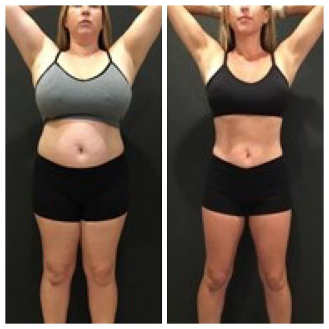 Everything you wanted to know about gastric balloon near me