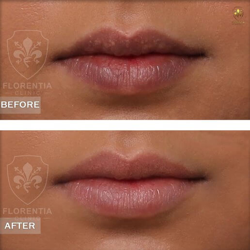 Best Aesthetic Clinic Dubai - Cosmetic Surgery by Expert Surgeon