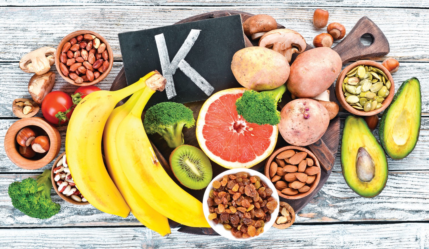 Preventing Kidney Stone Recurrence: Strategies for a Stone-Free Life