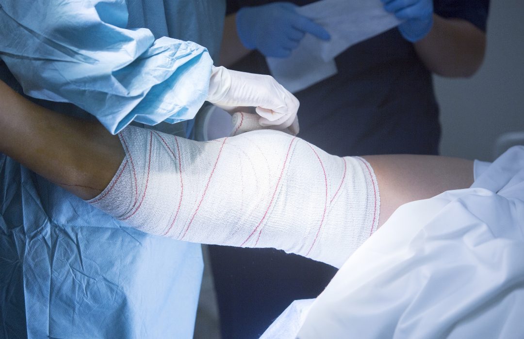 Experience Matters: Selecting the Best Shoulder Arthroscopy Surgeon