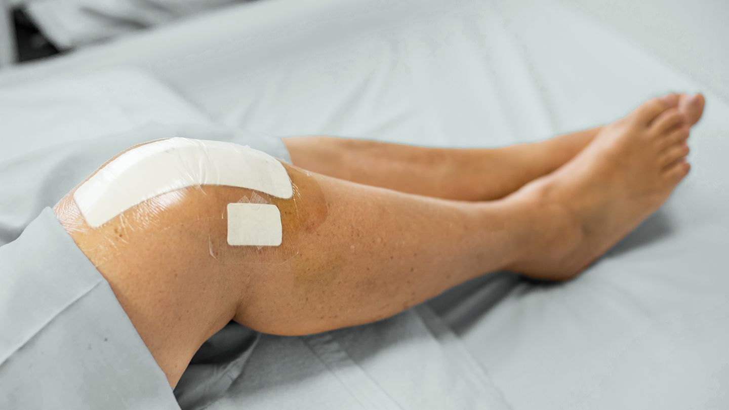 Regaining Mobility in Mumbai: Robotic Knee Surgery