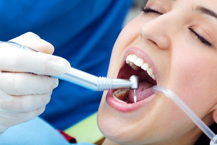 Common Misconceptions About Orthodontic Treatment -
