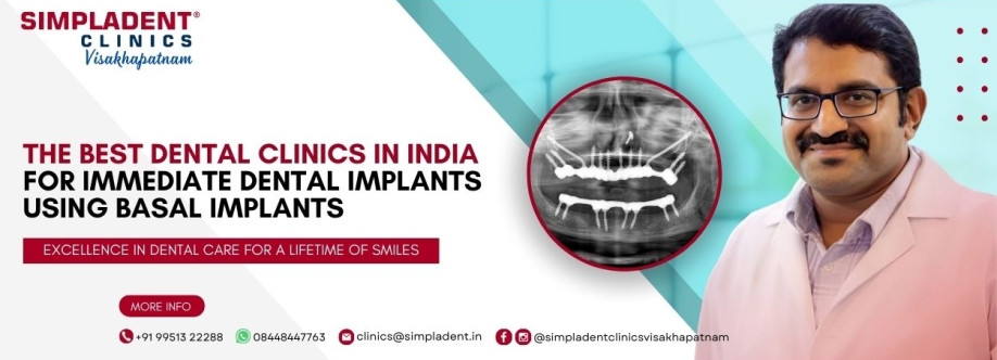 Full Mouth Dental Implants Surgery Cover Image
