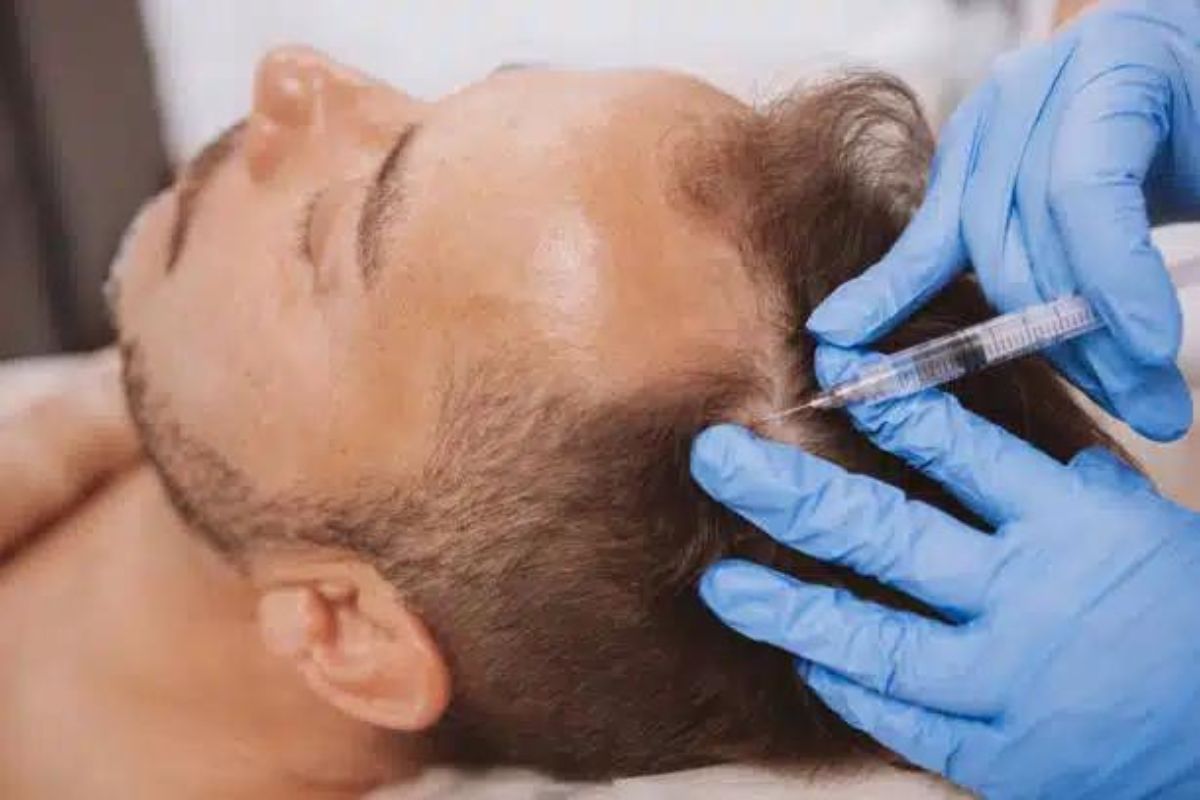 Hair Loss Treatment in India