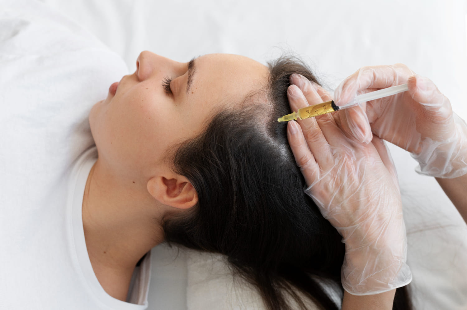 Hair PRP in Delhi – All You Need to Know - Crown - The Hair Transplant Experts