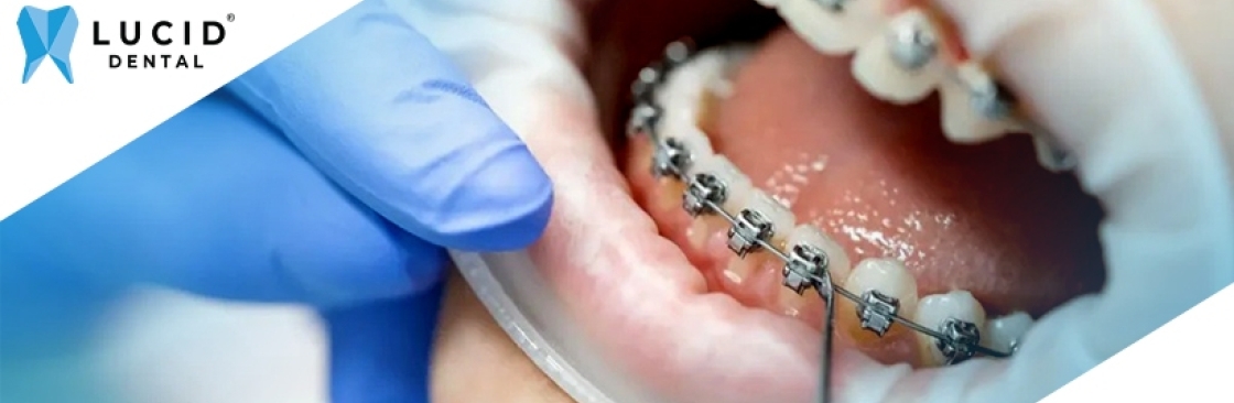 Lucid Dental Cover Image