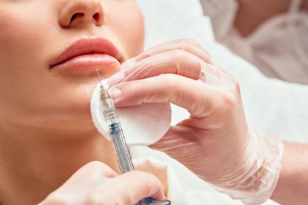 Step-by-Step Guide to Chemical Peels in Mississauga Article - ArticleTed -  News and Articles