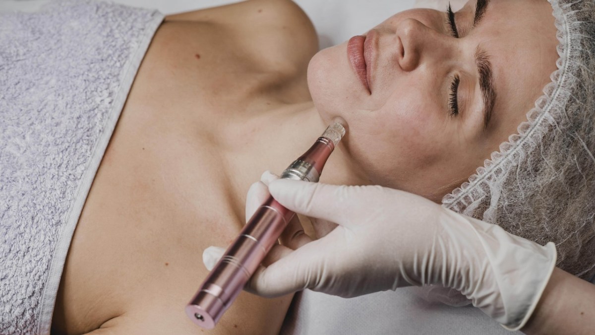 Benefits of Lip Fillers in Mississauga You Should Know – nebulawellness