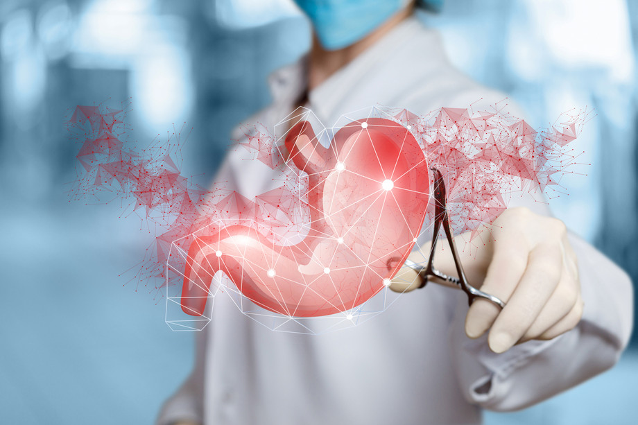 Gastric Banding vs Other Bariatric Procedures: Which Works Best? - JustPaste.it
