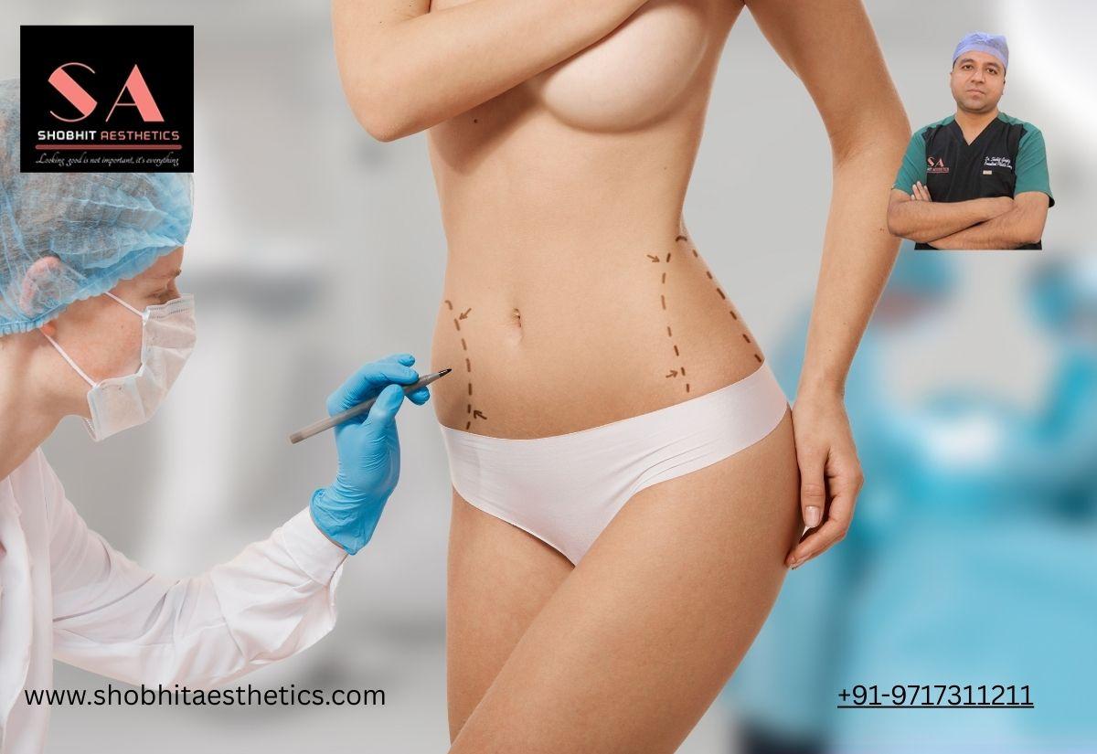 Brazilian Butt Lift in Delhi: Enhance Your Curves Naturally | Mạng...