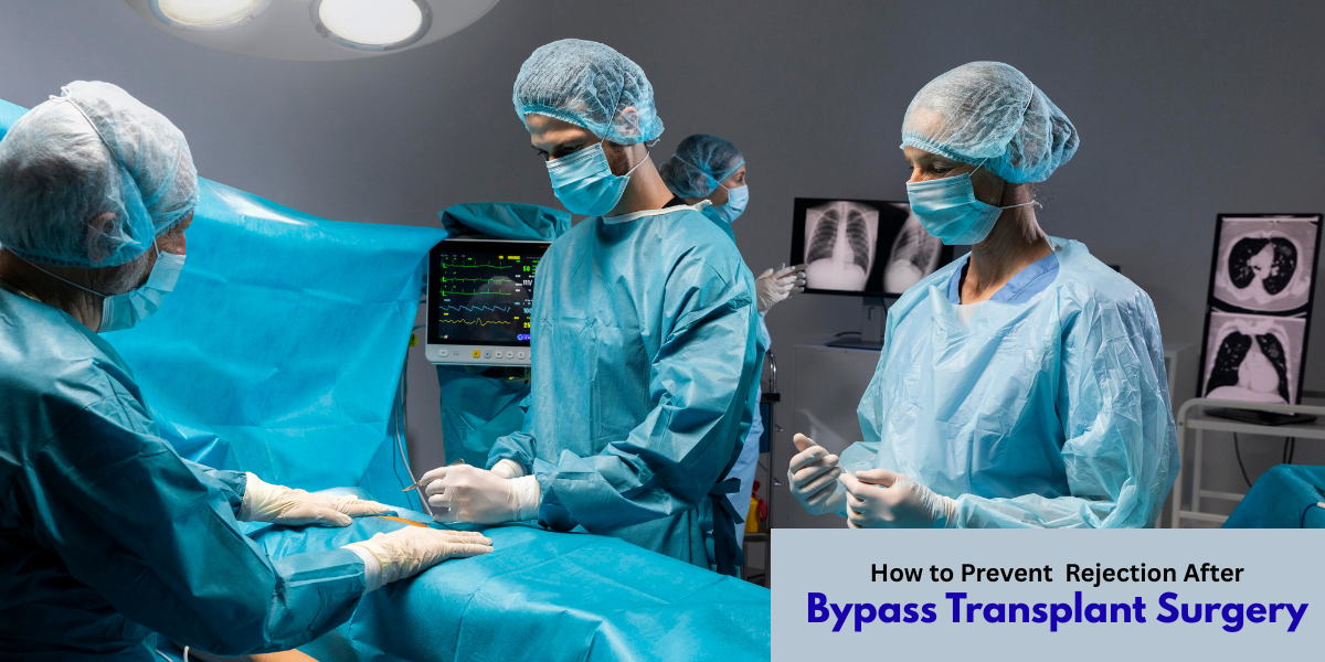 How to Prevent Rejection After Bypass Transplant Surgery... - Hasster