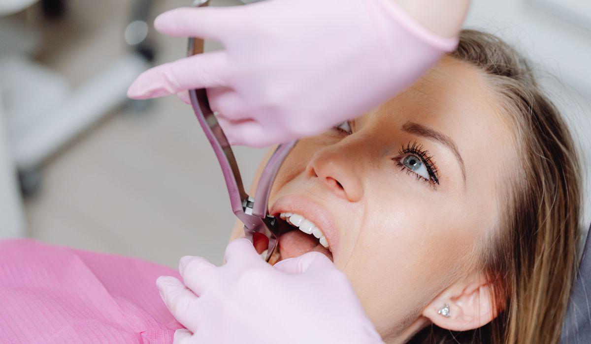 Are Affordable Teeth Veneer Durable and Long-Lasting? | La Lingua...