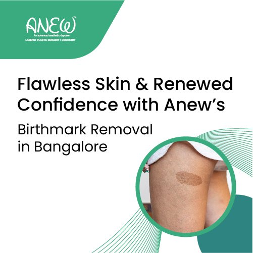 Best Laser Birth Mark Removal Treatment in Bangalore